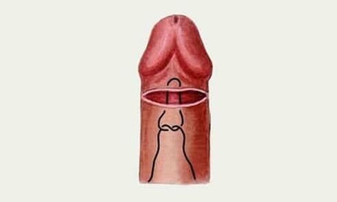 kelenjar penis